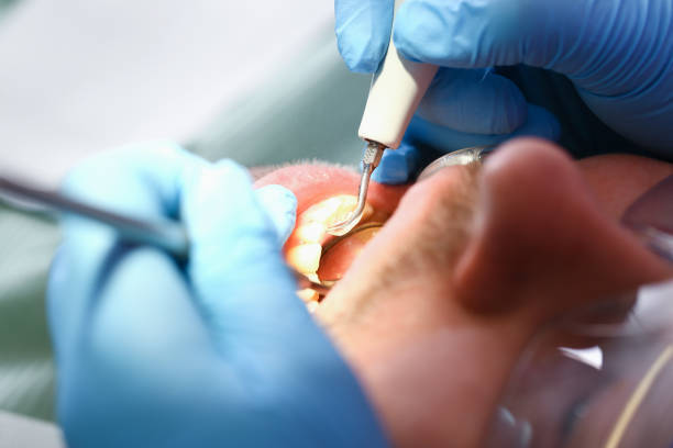 Best Emergency Dentist for Lost Fillings or Crowns in Coulee Dam, WA