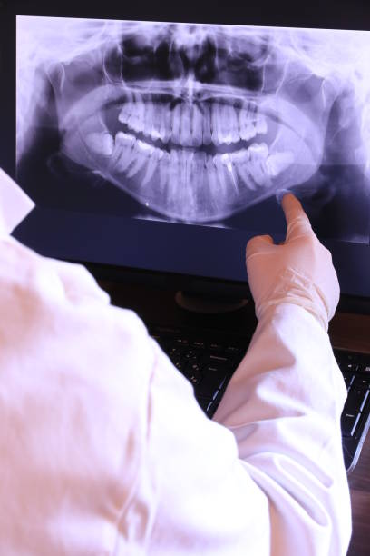 Best Emergency Dentist for Lost Fillings or Crowns in Coulee Dam, WA